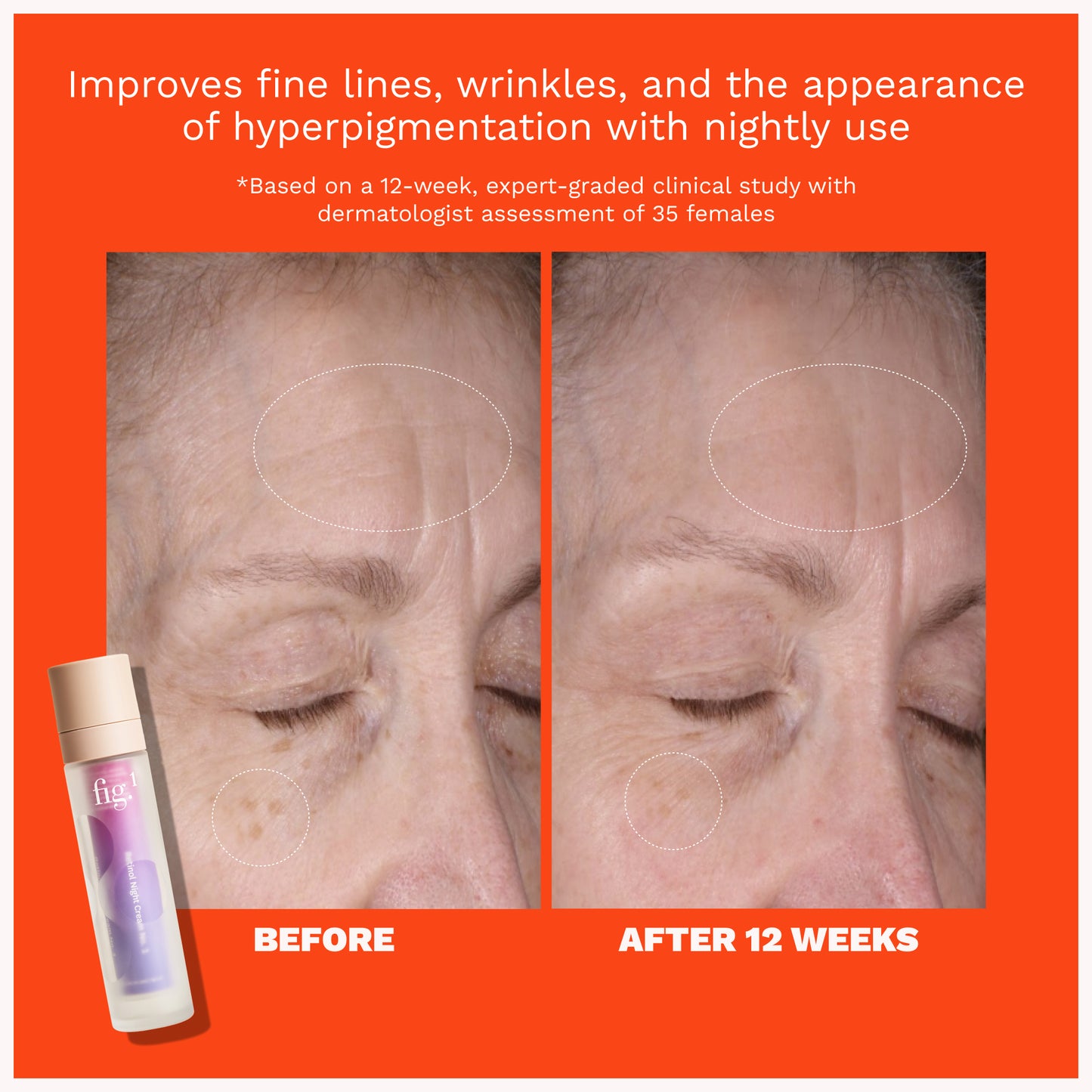 Retinol Night Cream Level 3