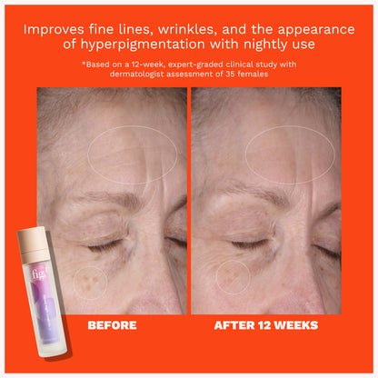 Retinol Night Cream Level 3