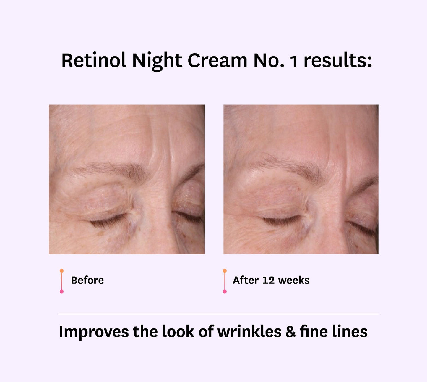 Intro to Retinol Bundle