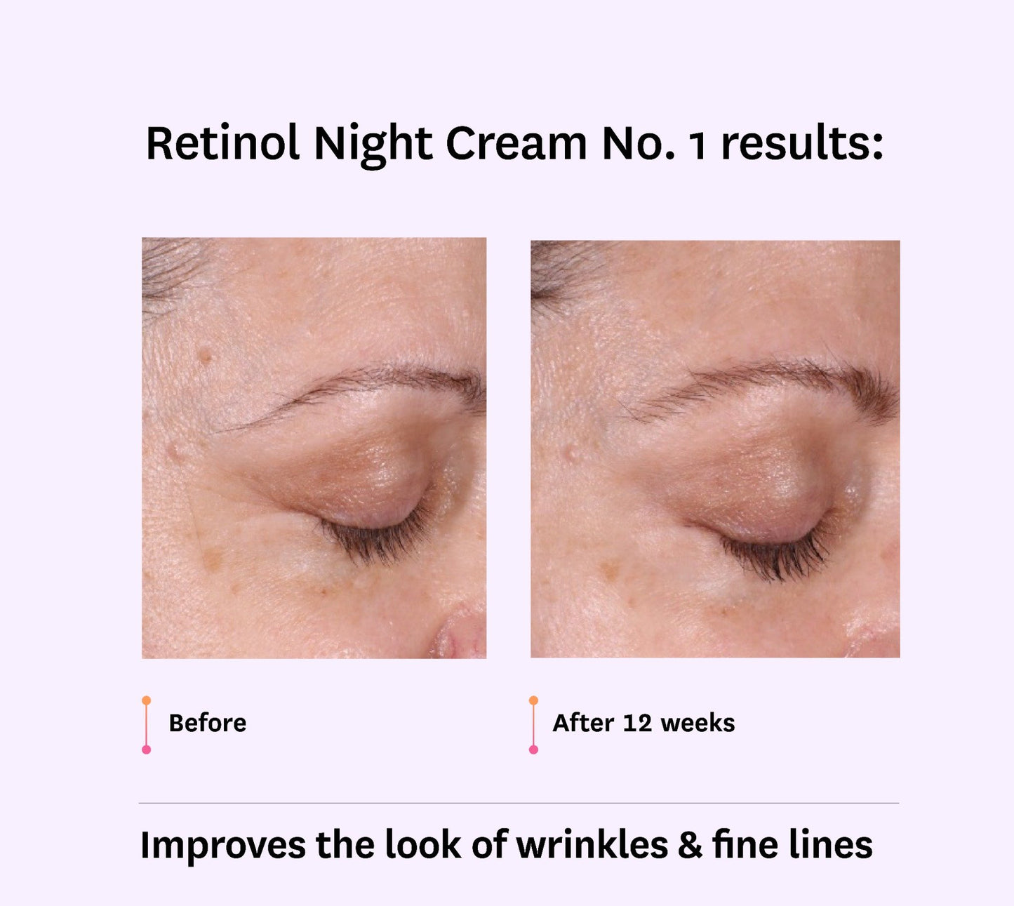 Intro to Retinol Bundle